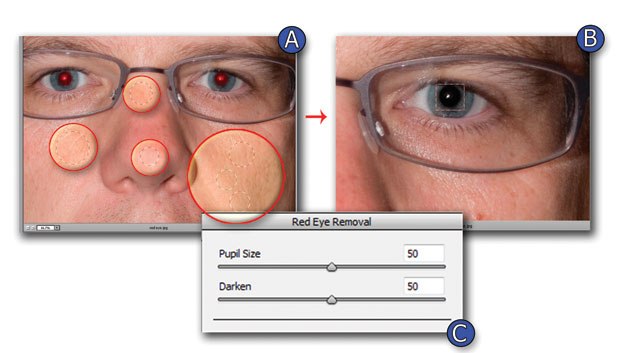 [Figure 1.79] View of red eye and multiple placements of Retouch/Nodes.