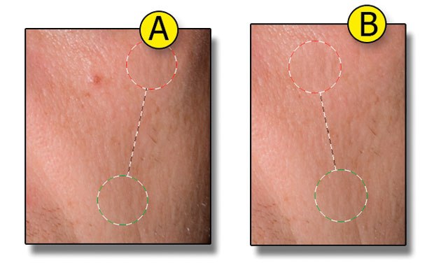 [Figure 1.77] Applying the Retouch tool to eliminate blemishes.